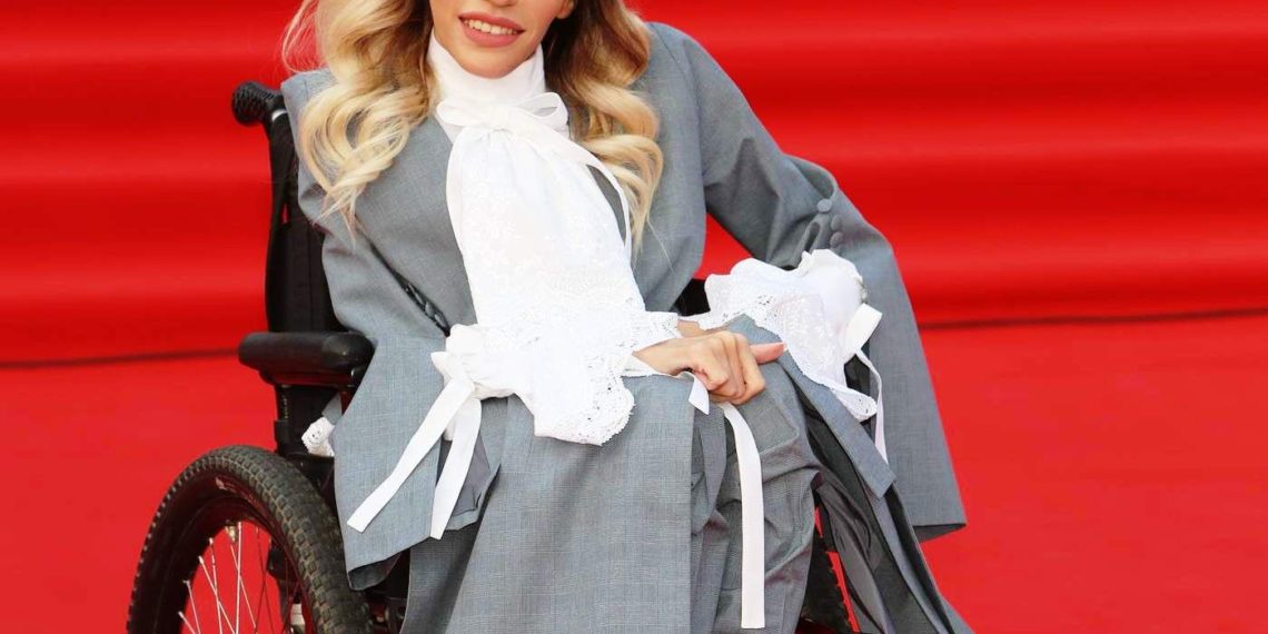 Участница Евровидения Юлия Самойлова рассказала о тяжелом детстве