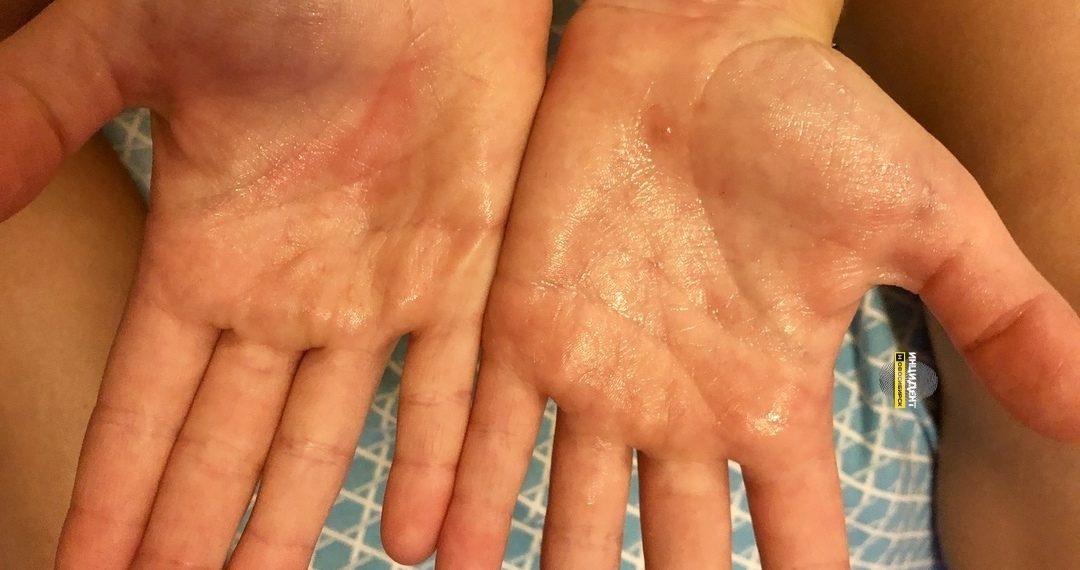 Инцидент Новосибирск