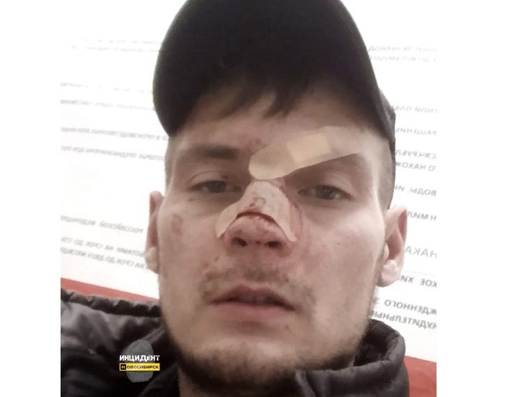 Охранник «Ашана» сломал нос новосибирцу