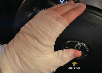 Новосибирец получил химические ожоги после поездки на электросамокате