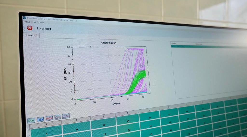 Ковид бьет по памяти: о когнитивных нарушениях рассказали эксперты