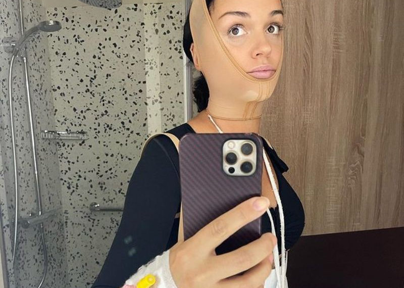 Слава легла под нож ради красоты