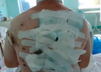 Выживший после 70 ножевых школьник впервые рассказал о случившемся