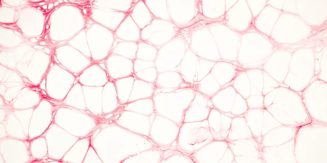 Подробности новосибирского препарата против разрыва сосудов рассказали в Минздраве