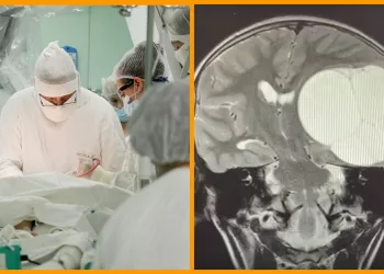 Школьник из Челябинска несколько месяцев жил с личинками паразита в мозгу