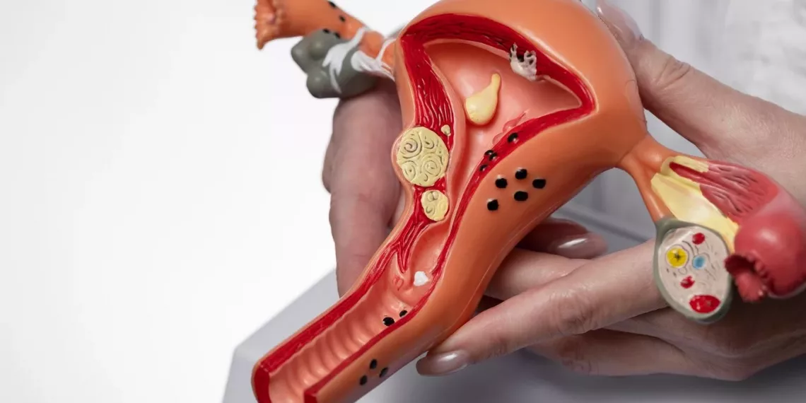 В Новосибирске ученые выявили признаки генетической склонности к развитию миомы матки