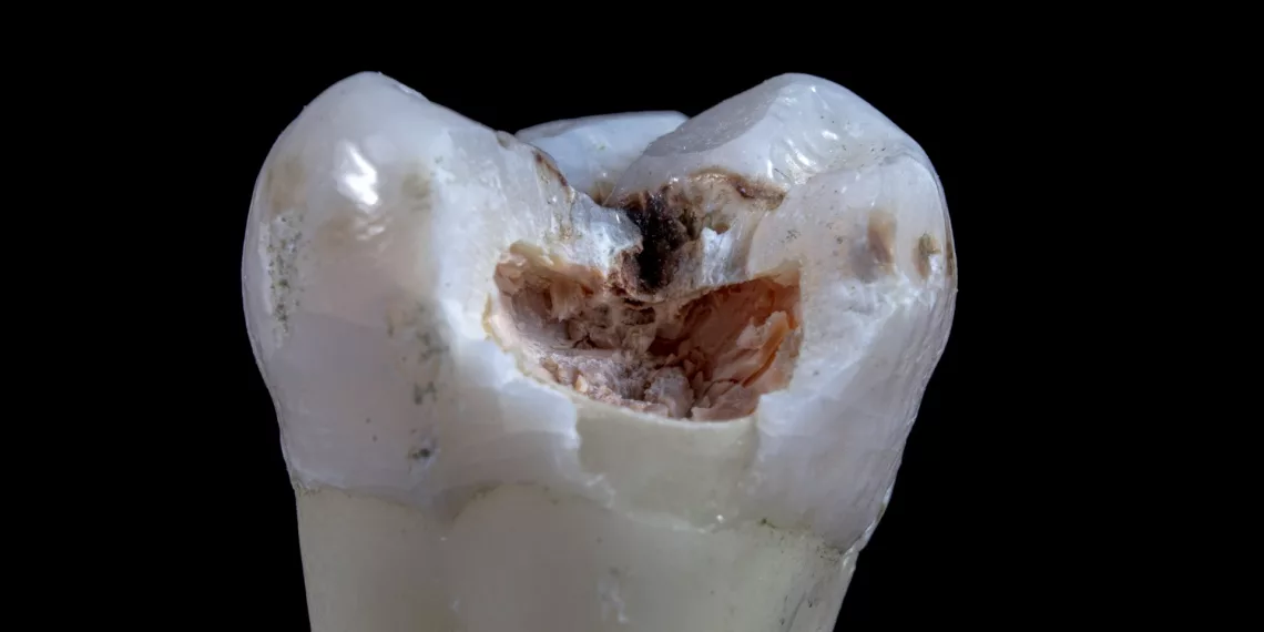 Вакцину от кариеса создают в Беларуси