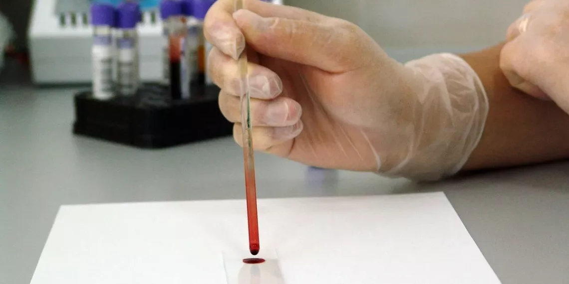 Российские ученые создали сорбент для очистки крови от вирусов и токсинов