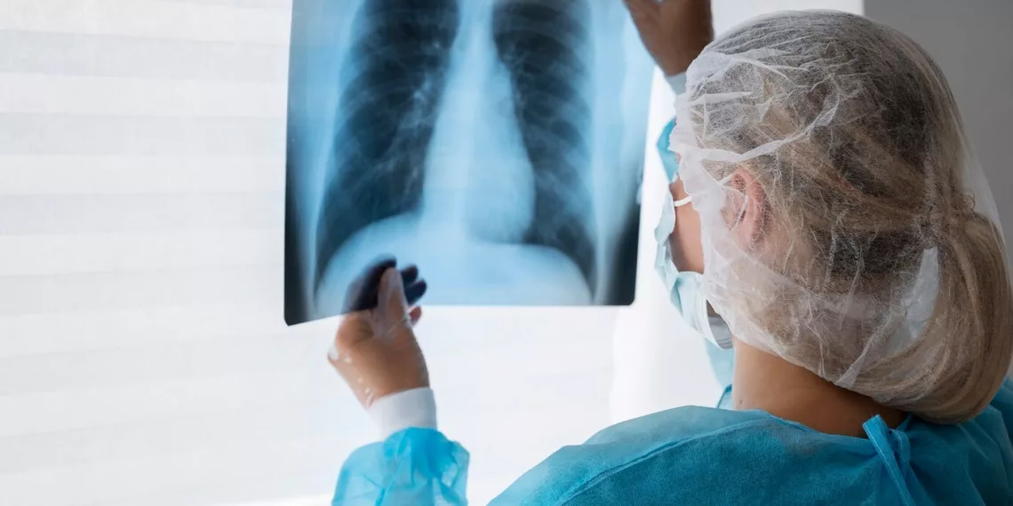 Обследование на туберкулез смогут бесплатно пройти жители Новосибирска