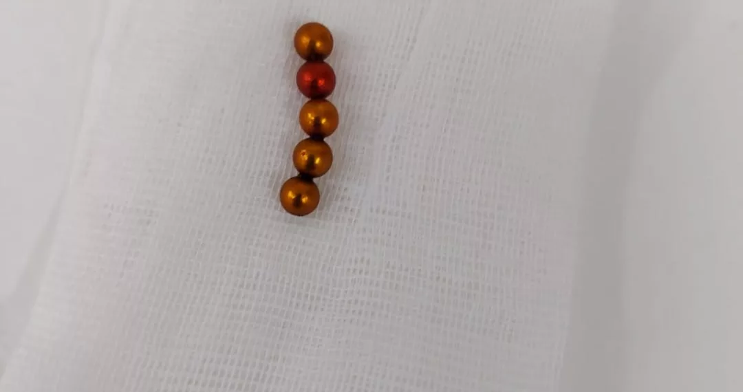 Томские врачи спасли ребенка, удалив опасные магниты из его живота