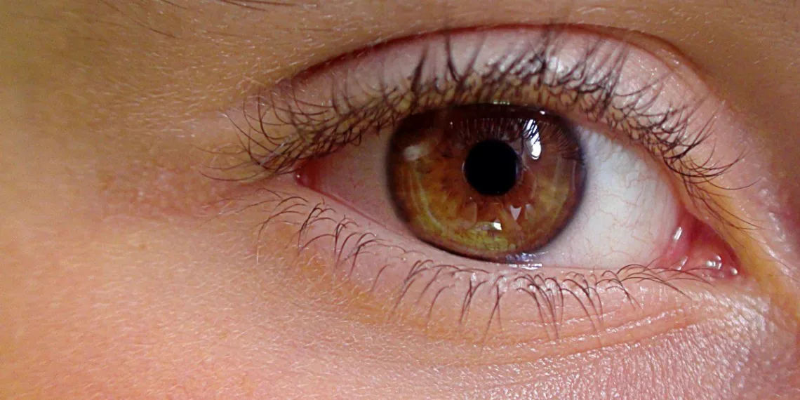 Ученые выявили неожиданный фактор развития глаукомы