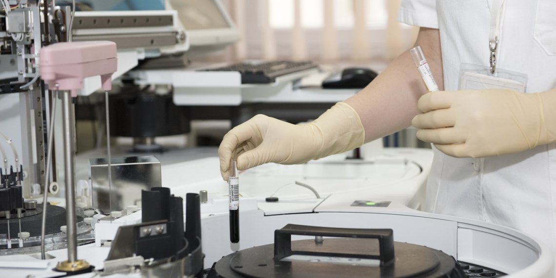 Ученые выяснили, какая ягода способна предотвратить диабет и сердечно-сосудистые заболевания