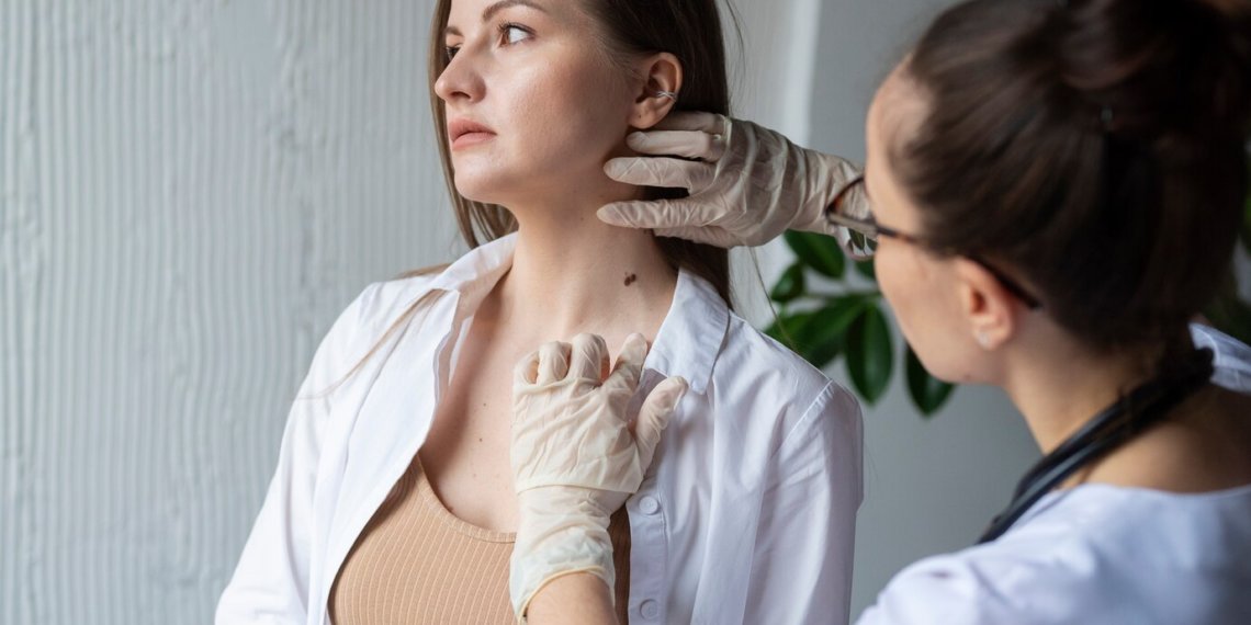 Бесплатно провериться на рак кожи приглашают жителей Новосибирска