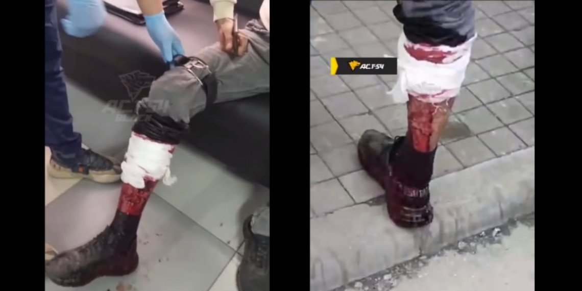 Продавец автомобилей прострелил ногу клиенту в Новосибирске