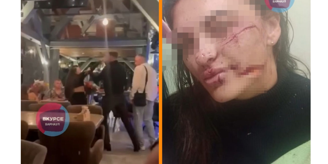 Неадекватный мужчина разбил стакан о лицо девушки в Белокурихе