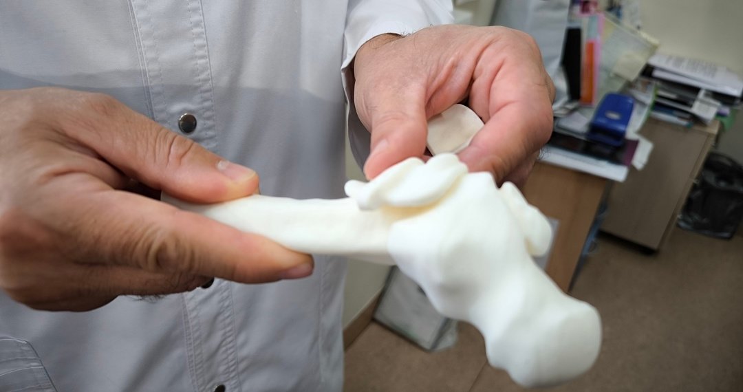 Новосибирские хирурги установили 3D-конструкцию 10-летнему мальчику с редкой аномалией