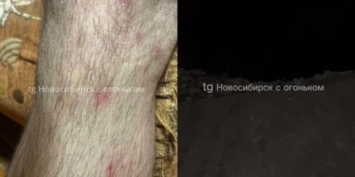 Новосибирец упал в разрытую яму в Дзержинском районе