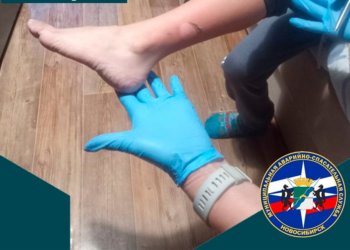 Застрял в батарее и получил ожог семилетний ребенок в Новосибирске