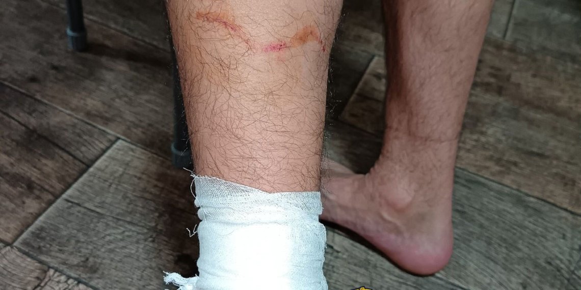 Стая агрессивных собак окружила и напала на мужчину в Новосибирске