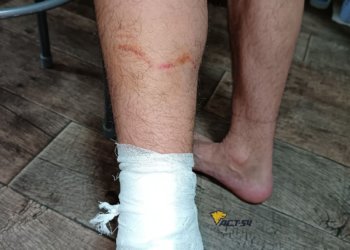 Стая агрессивных собак окружила и напала на мужчину в Новосибирске