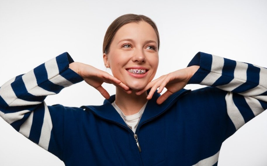 Стоимость брекетов выросла до полумиллиона рублей в России