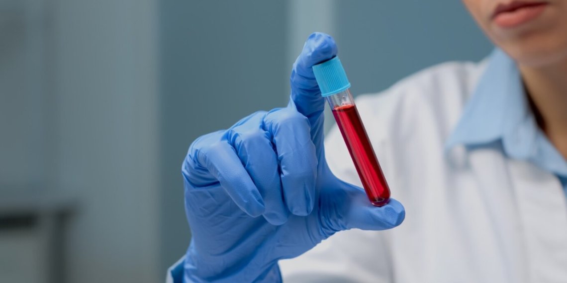 Стало известно, где можно бесплатно провериться на ВИЧ в Новосибирске