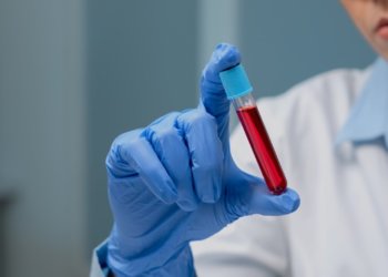 Стало известно, где можно бесплатно провериться на ВИЧ в Новосибирске