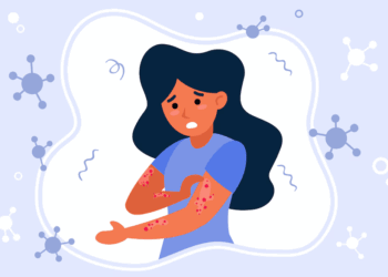 «Это не связано с ослаблением иммунитета»: новосибирский врач рассказала, как «работает» аллергия