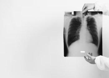 В Новосибирской области за год втрое выросла смертность от внебольничной пневмонии