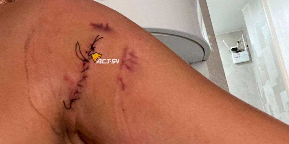 МВД проверяет драку с поножовщиной из-за детского совка на берегу Оби