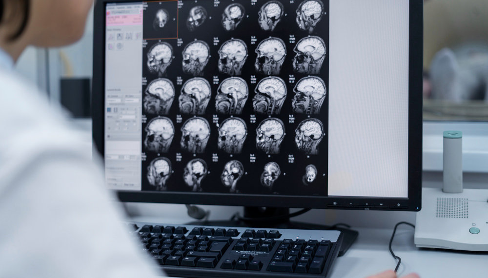 Нейросеть научили находить опухоли мозга и туберкулез по снимкам в Новосибирске