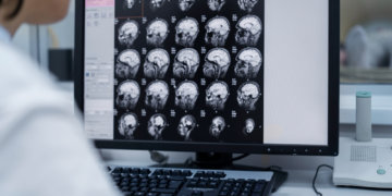 Нейросеть научили находить опухоли мозга и туберкулез по снимкам в Новосибирске