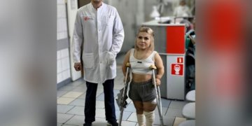 Новосибирские хирурги помогли пациентке с разной длиной ног с помощью эндопротеза