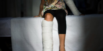 Пенсионерка сломала ногу в новосибирском троллейбусе и подала в суд