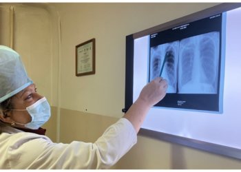 ВИЧа и туберкулёза становится меньше в Новосибирской области