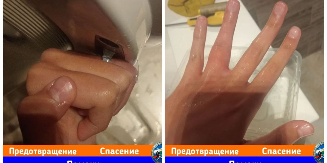 Игрушки, бутылки, стиральная машина: от чего МАСС спасают детей каждый день