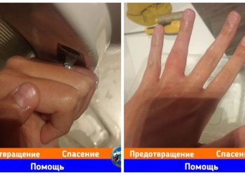 Игрушки, бутылки, стиральная машина: от чего МАСС спасают детей каждый день