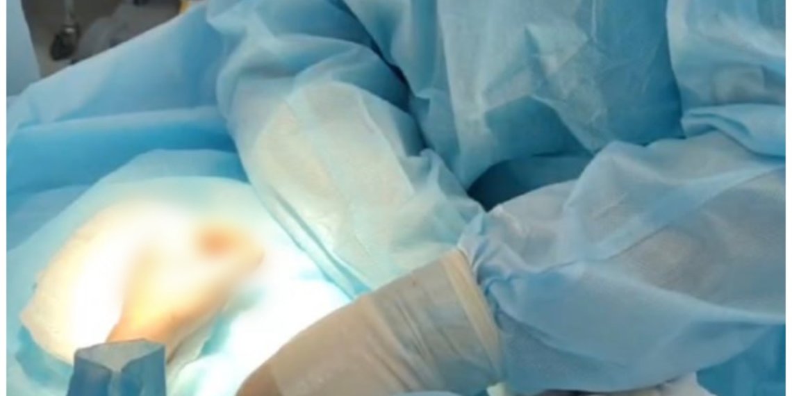 Пострадавшему от взрыва петарды мальчику ампутировали палец