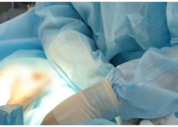 Пострадавшему от взрыва петарды мальчику ампутировали палец