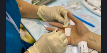 Жителей Новосибирской области бесплатно протестируют на ВИЧ и гепатит С