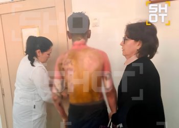 Ученица ворвалась в класс с молотком и бензином: в красноярской школе ранены шесть человек, один — с ожогами 50% тела