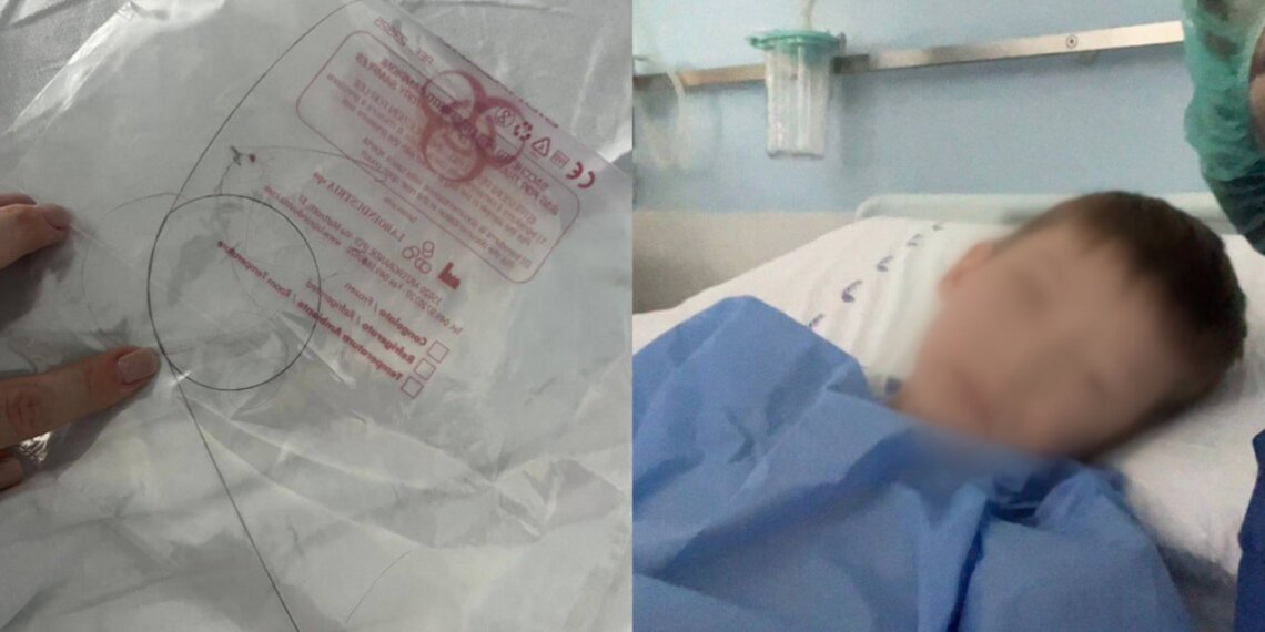 В Новосибирске врачи забыли в теле ребёнка инородный предмет