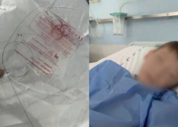 В Новосибирске врачи забыли в теле ребёнка инородный предмет