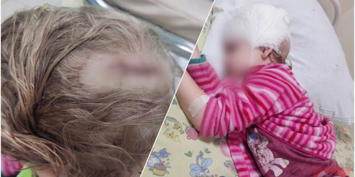 4-летняя девочка получила серьёзные травмы после падения в открытый колодец под Новосибирском