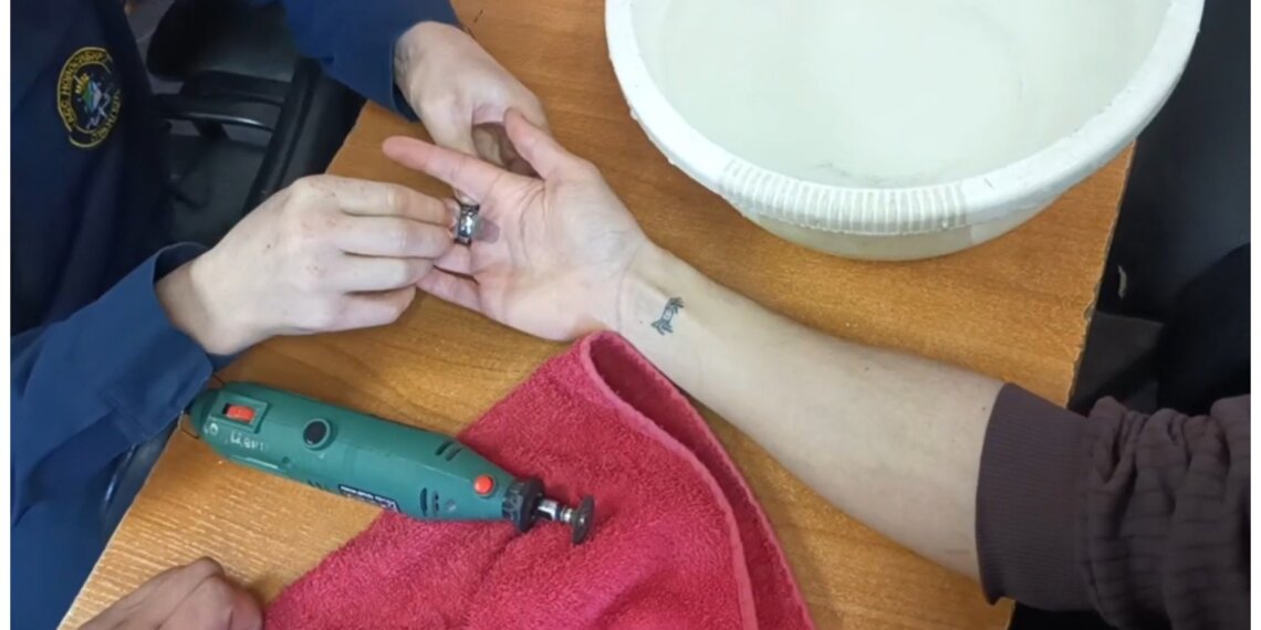 Новосибирским спасателям пришлось выручать 21-летнего парня из «капкана» кольца