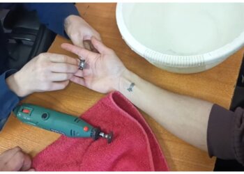 Новосибирским спасателям пришлось выручать 21-летнего парня из «капкана» кольца