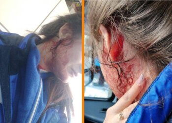 Женщина жестоко избила фельдшеров скорой помощи в Сибири