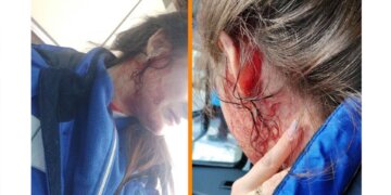 Женщина жестоко избила фельдшеров скорой помощи в Сибири