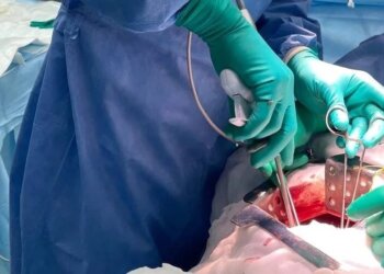 Новосибирские хирурги выполнили уникальную операцию: удалили опухоль 15 см, сохранив желудок