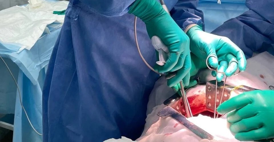 Новосибирские хирурги выполнили уникальную операцию: удалили опухоль 15 см, сохранив желудок